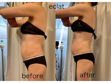 エクラ 五反田(eclat)/本気改善　痩身　歪み　代謝UP