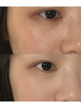 ユミサロン(U Mi Salon)/