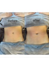 ラローゼ トウキョウ(LA ROSEE TOKYO)/ハイパーナイフ&シェイプ&EMS