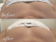 ミランサ ギンザ(MIRANSA GINZA)/【バストアップケア】ACバスト