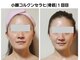 セレブリティ(Celebrity)の写真