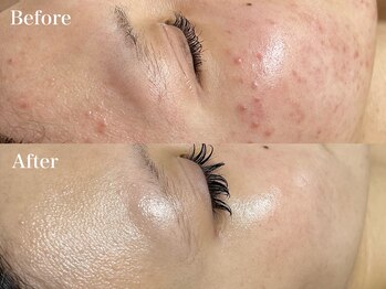 マシェ バイ マユ(Mache by Mayu)/当店に来てから別人級