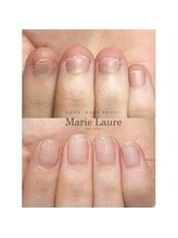 マリーロール 淀屋橋本店(Marie Laure)/深爪矯正/自爪育成/ネイルケア