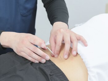 ハレルヤ鍼灸治療院/鍼施術