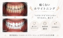 ホクリノ(Hokulino)
