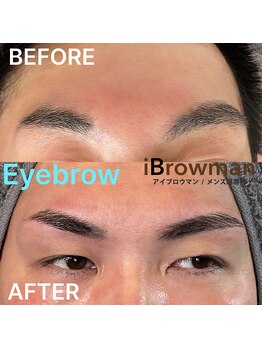 アイブロウマン(i Browman)/施術例