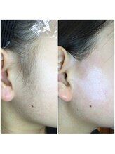 カルム(Calme)/もみあげWAX