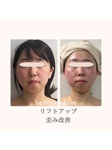 美キュール 栄店(cuol)/フェイスラインすっきり！