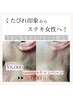【8月中キャンペーン】レディース脱毛うなじ＆もみ上げSET　￥8,000→￥5,000