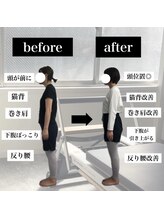 アイル(I'll)/before/after
