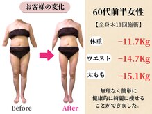 ベルホワイト(Belle White)/【60代前半/4ヶ月の変化】