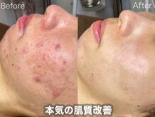 ラティーナ(Lattina)