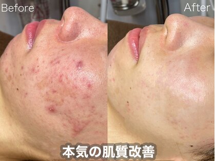 ラティーナ(Lattina)の写真