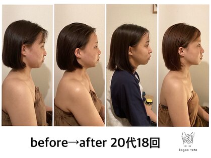 コガオテテ(Kogao tete)の写真