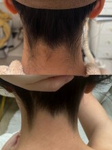 さとう美容整体 川崎本店/うなじシェービング