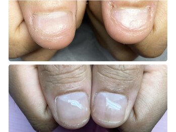 リベルタ(Liberta)/爪育