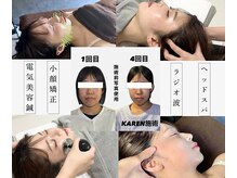 クリアランス 南青山(CLEARANCE)/4回の施術効果　KAREN担当