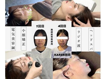 クリアランス 南青山(CLEARANCE)/4回の施術効果 KAREN担当
