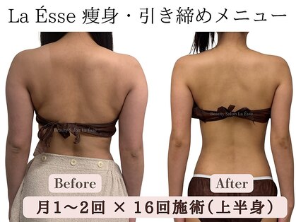 ラエッセ(La Esse)の写真