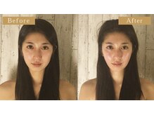 グレースフィオーレ 南越谷店(gracefiore)/小顔｜毛穴｜肩こり改善