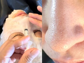 マヴィ くずは店(MavY.)/専用溶剤で毛穴の汚れを浮かす