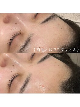 アイミーモア 国立店(aimer more)/眉毛ワックス+おでこワックス