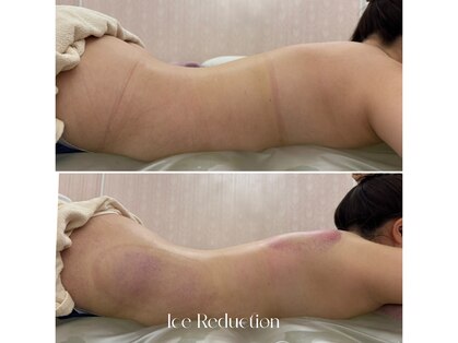 エステティックサロン フェアリー(ESTHETIC SALON FAIRLY)の写真