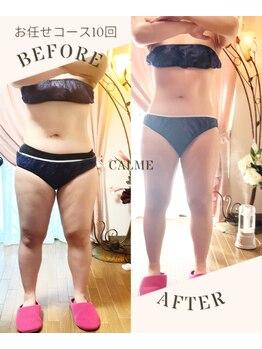 キャルム/お任せコース