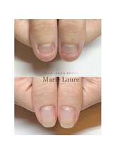 マリーロール 淀屋橋本店(Marie Laure)/深爪矯正/自爪育成/ネイルケア