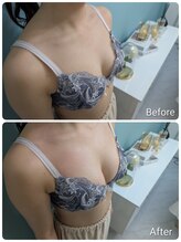 美人バスト 柏店/【バストアップ・育乳】症例