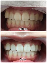 ドクターモック(Dr.MOC)/ＢＥＦＯＲＥ→ＡＦＴＥＲ