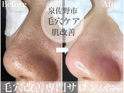 リル 泉佐野(Rire)の写真