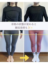 ポノフィット(PONO FIT.)&nbsp;症例 お任せ