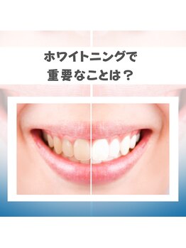 プラスビーセルフ(+b self)/ホワイトニングで重要なこと