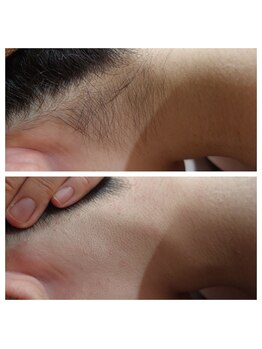 エステティック レイビス 青森店(RAYVIS)/意外と見られてる後ろ姿!