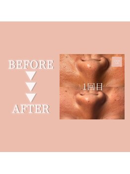 クリアラボ 日本橋(Clear Lab)/Before＆After