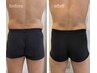 【OPEN記念半額！】最強痩身セット！脂肪冷却２カップ＋エムスレンダー30分