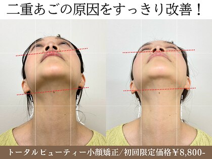 ナチュラルビューティーフェイス 横浜(NBF)の写真