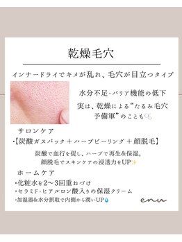 エヌ(enu)/毛穴洗浄/フェイシャル