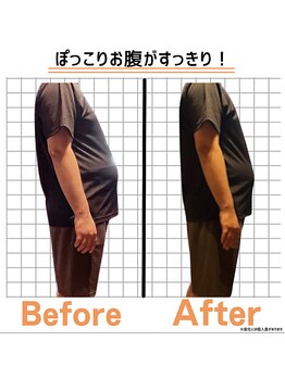 整体ハロ(整体HALO)/下腹ぽっこり/猫背