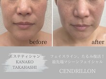 Beauty salon CENDRILLON【サンドリヨン】の雰囲気(【最先端マシーンフェイシャル】フェイスライン、たるみ復活!)