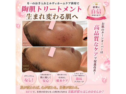 美肌ラボ シーズンズ(SEASON'S)の写真