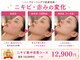 ケイ(K)の写真