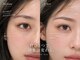 オーラエム(Aura M)の写真