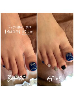 トータルビューティーサロン マイスター(MEISTER)/wax脱毛両足全体