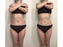 ジュメル 恵比寿店(Jumelles)/やっぱり憧れ綺麗なくびれ