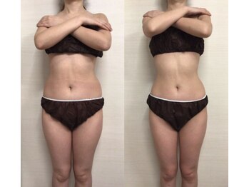 ジュメル 恵比寿店(Jumelles)/やっぱり憧れ綺麗なくびれ