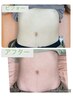 【新規のお客様限定♪】ダイエット痩身機器　20分　2000円