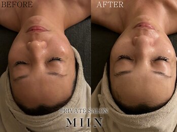 ミイン(miin)/韓国肌管理LHALALAララピール