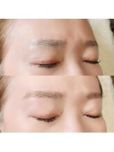 アール(R.)/ハリウッドブロウリフト